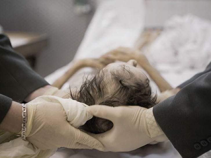 El papel de un antropólogo forense
