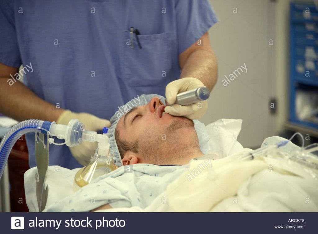 Intubación en secuencia rápida ¿Qué es RSI? 3 ARCRT8