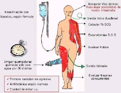 quemadura y enfermeria