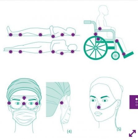 Escalas de Úlceras por presión 5 Escalas de Úlceras por presión