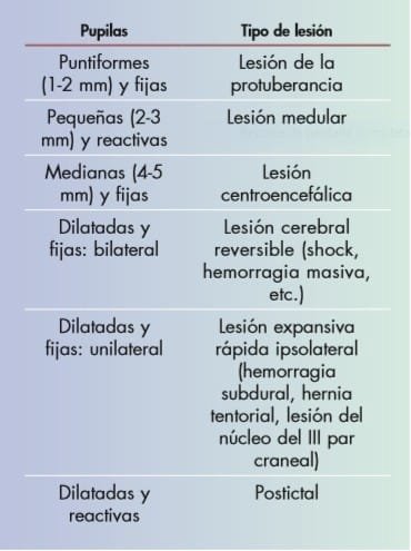 Exploración pupilar
