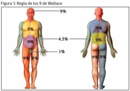 Acciones de enfermería en paciente Gran Quemado 4 quemados 1