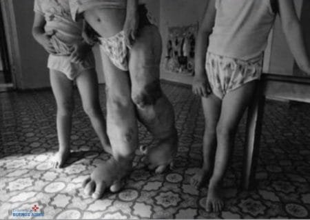 ¿Qué efectos produce la radiación nuclear en el cuerpo? 16 ¿Qué efectos produce la radiación nuclear en el cuerpo?