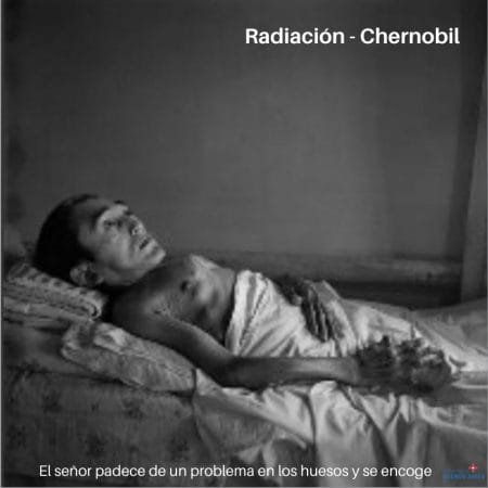 ¿Qué efectos produce la radiación nuclear en el cuerpo? 15 ¿Qué efectos produce la radiación nuclear en el cuerpo?