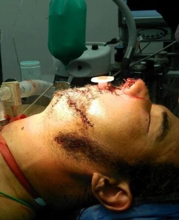 Herida por arma de fuego 5 Herida por arma de fuego